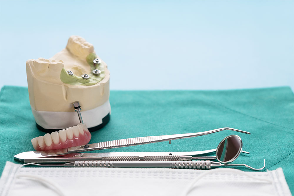 Zahnimplantat-Arbeiten-ist-abgeschlossen-gebrauchsfertiges-Zahnimplantat-provisorisches-Abutment