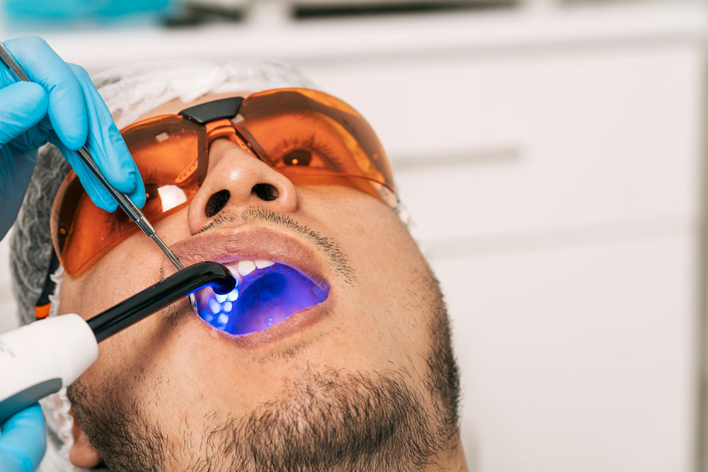 Zahnarzt-Bleaching-Patientenzähne-mit-Laser-Zahnklinik